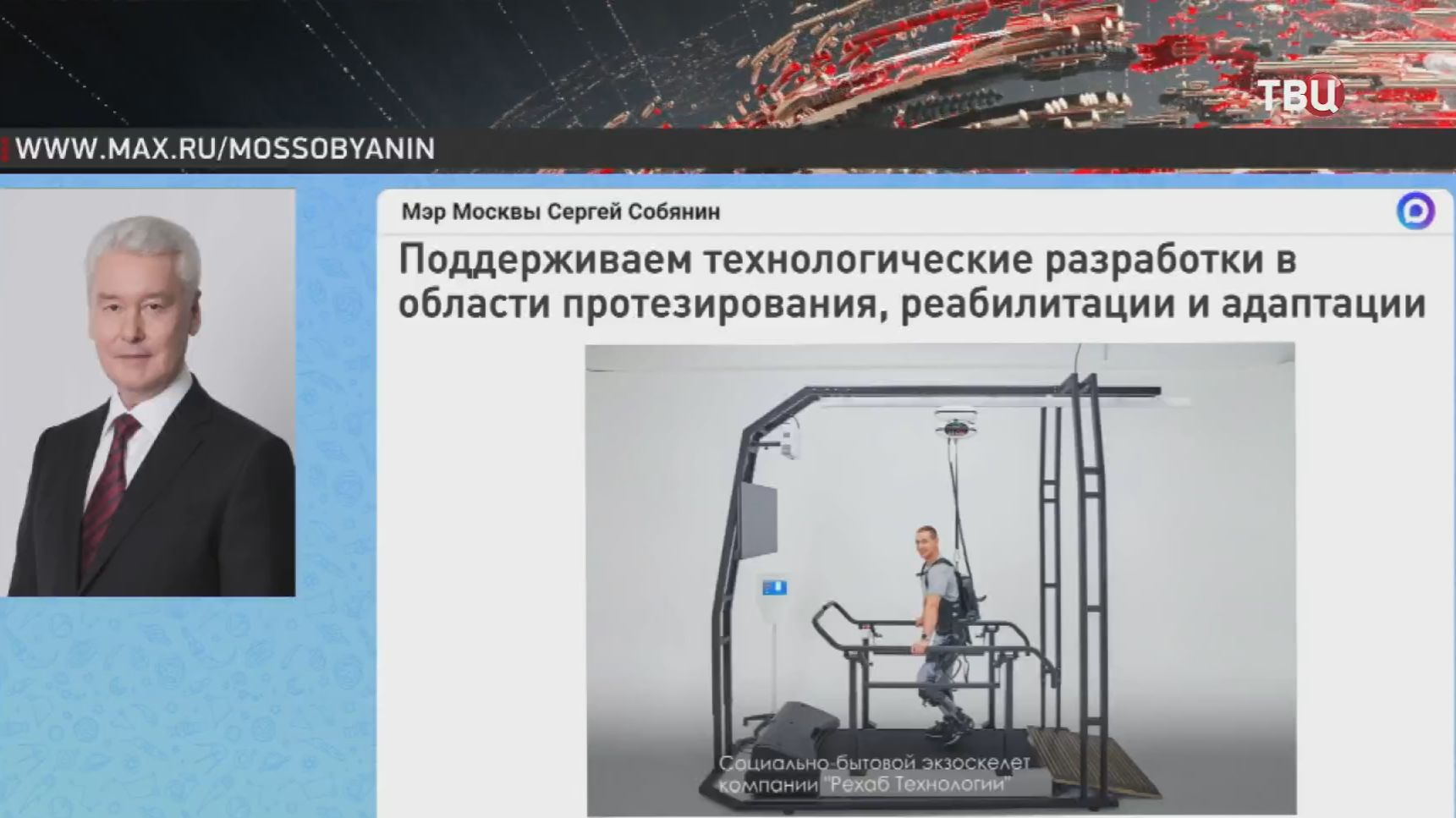 Собянин: Москва поддерживает разработки в области протезирования и реабилитации смотреть онлайн