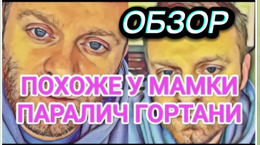 САМВЕЛ АДАМЯН, ОБЗОР ОТ ОЛЬГИ, ПОХОЖЕ У МАМКИ ПАРАЛИЧ ГОРТАНИ, ВРАЧИ НЕ ПОМОГУТ, ЕСЛИ САМА НЕ ЗАХОЧЕ смотреть онлайн
