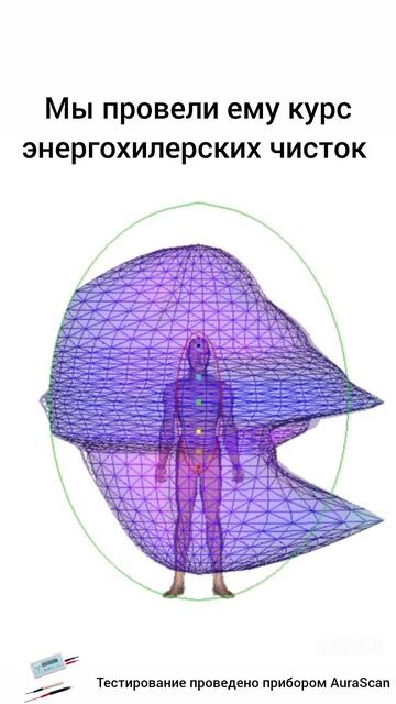 ДИНАМИКА АУРЫ на чистке Некротической привязки AuraScan