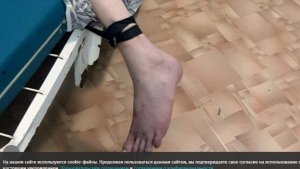 Общественник сообщил о жестоком обращении с постояльцем в кузбасском интернате