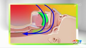 Капы от храпа: чудо или миф? Жить здорово! Фрагмент выпуска от 29.01.2026