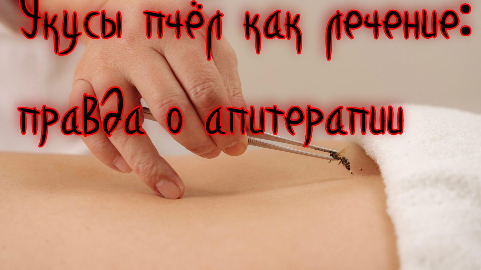 ЧТО ЛЕЧАТ ПЧЕЛЫ Апитерапия пчелоужаливание смотреть онлайн