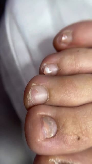 Вот оно идеальное состояние стоп  результат Smart Педикюра  пленка на ногти! 