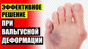 Фиксатор для пальцев ног 🔔 Кость на стопе сбоку как называется 👍