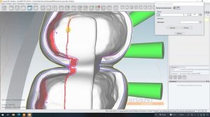 Балка и ответка на культях