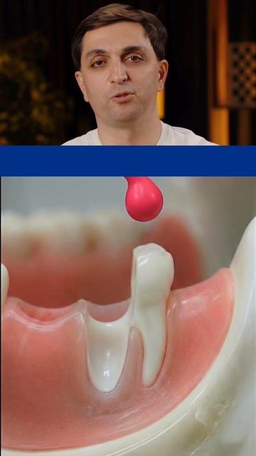 Современные технологии помогают сохранить даже сложные зубы.