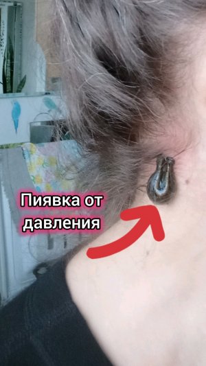 Пиявка от давления.