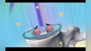 как возникает грыжа позвоночника