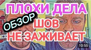 САМВЕЛ АДАМЯН, ОБЗОР ОТ ОЛЬГИ, ШОВ НЕ ЗАЖИВАЕТ, ВЗЯЛИ ПОСЕВ ИЗ РАНЫ, СЕПСИС ПРОШЕЛ..