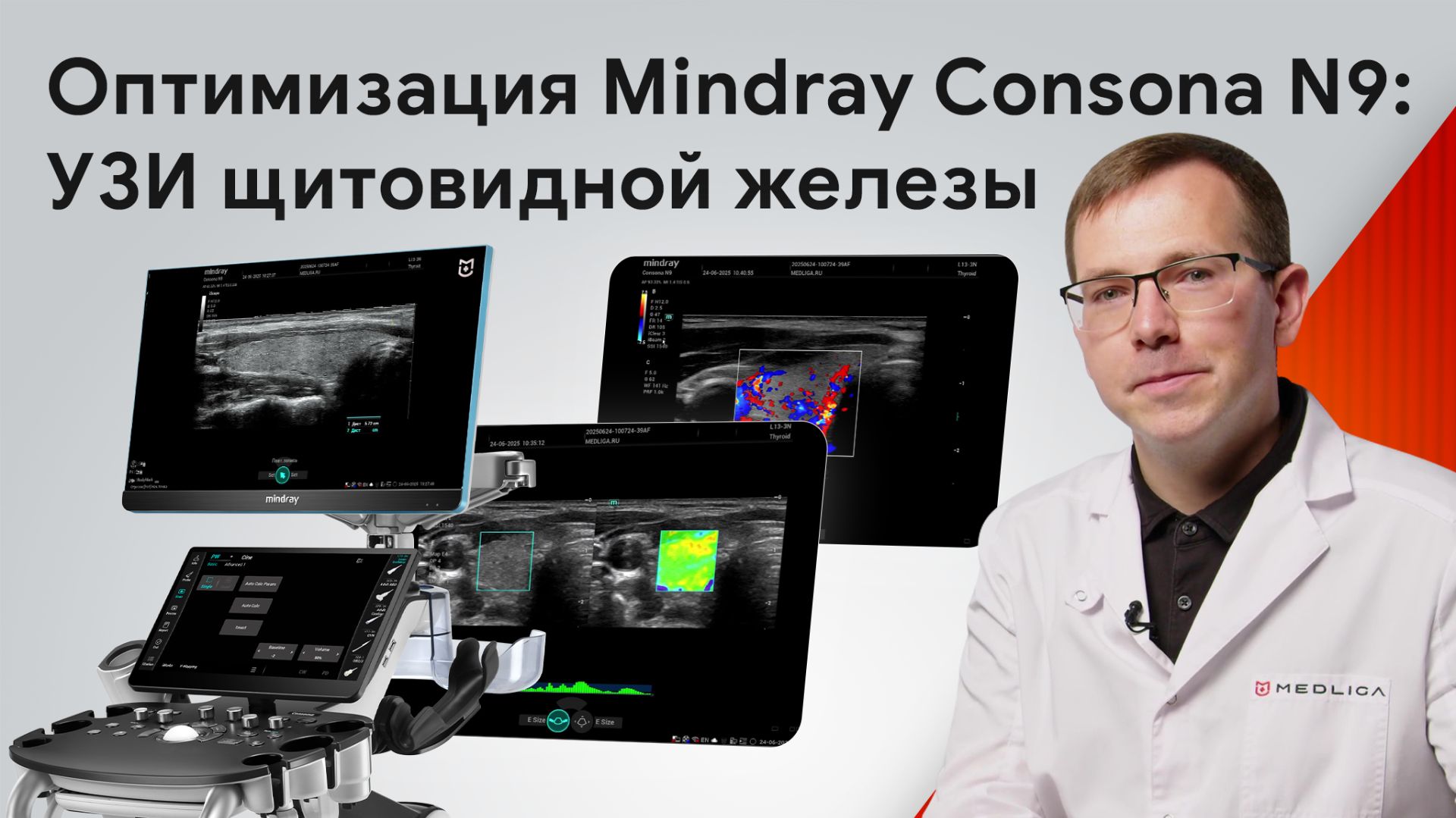 Настройка Mindray Consona N9 для точного сканирования щитовидной железы смотреть онлайн