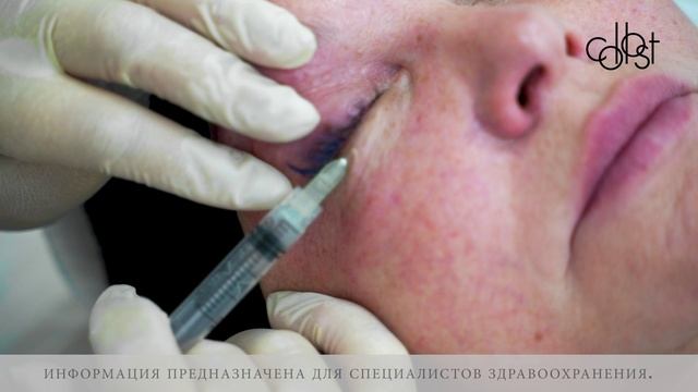 Области применения COLLOST ® micro 0,05 г смотреть онлайн