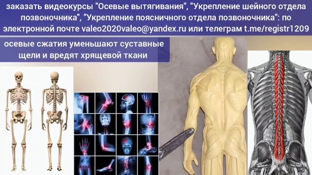 Осевые сжатия разрушают шею в области атланта, позвоночник и суставы ног. Польза осевых вытягиваний смотреть онлайн
