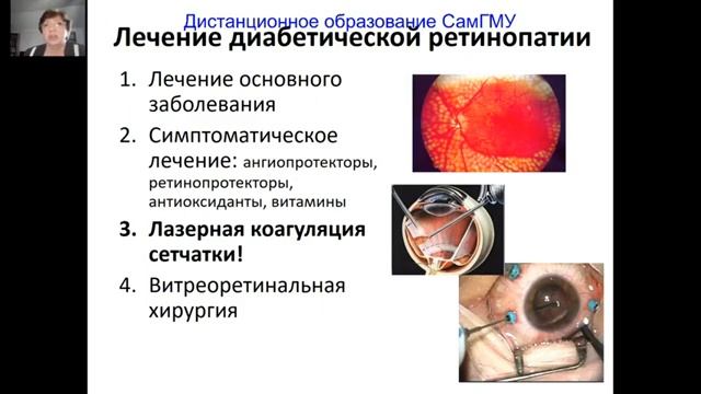 Патология глазного дна смотреть онлайн
