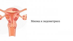 Вебинар по миомам и эндометриозу