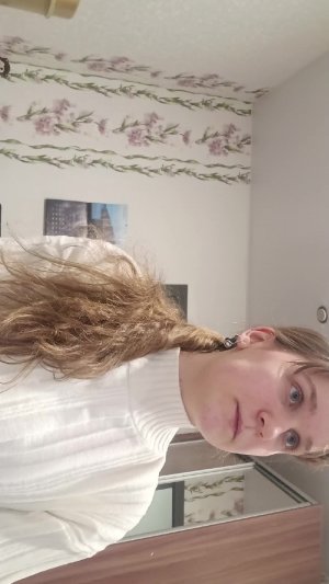 5 день после операции