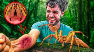 Укусил Банановый паук. Самые сильные укусы в мире