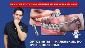 Как сократить срок лечения на брекетах на 40%?