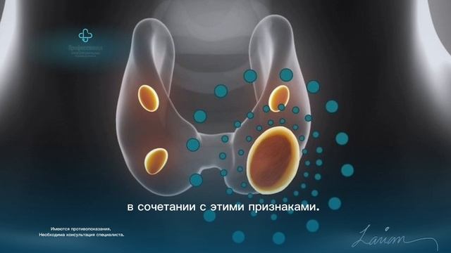 Нашли по УЗИ узлы в щитовидной железе. Что делать?