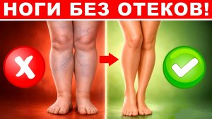 СЕКРЕТ СТРОЙНЫХ НОГ БЕЗ ОТЕКОВ! | Простая гимнастика СПАСАЕТ НОГИ!