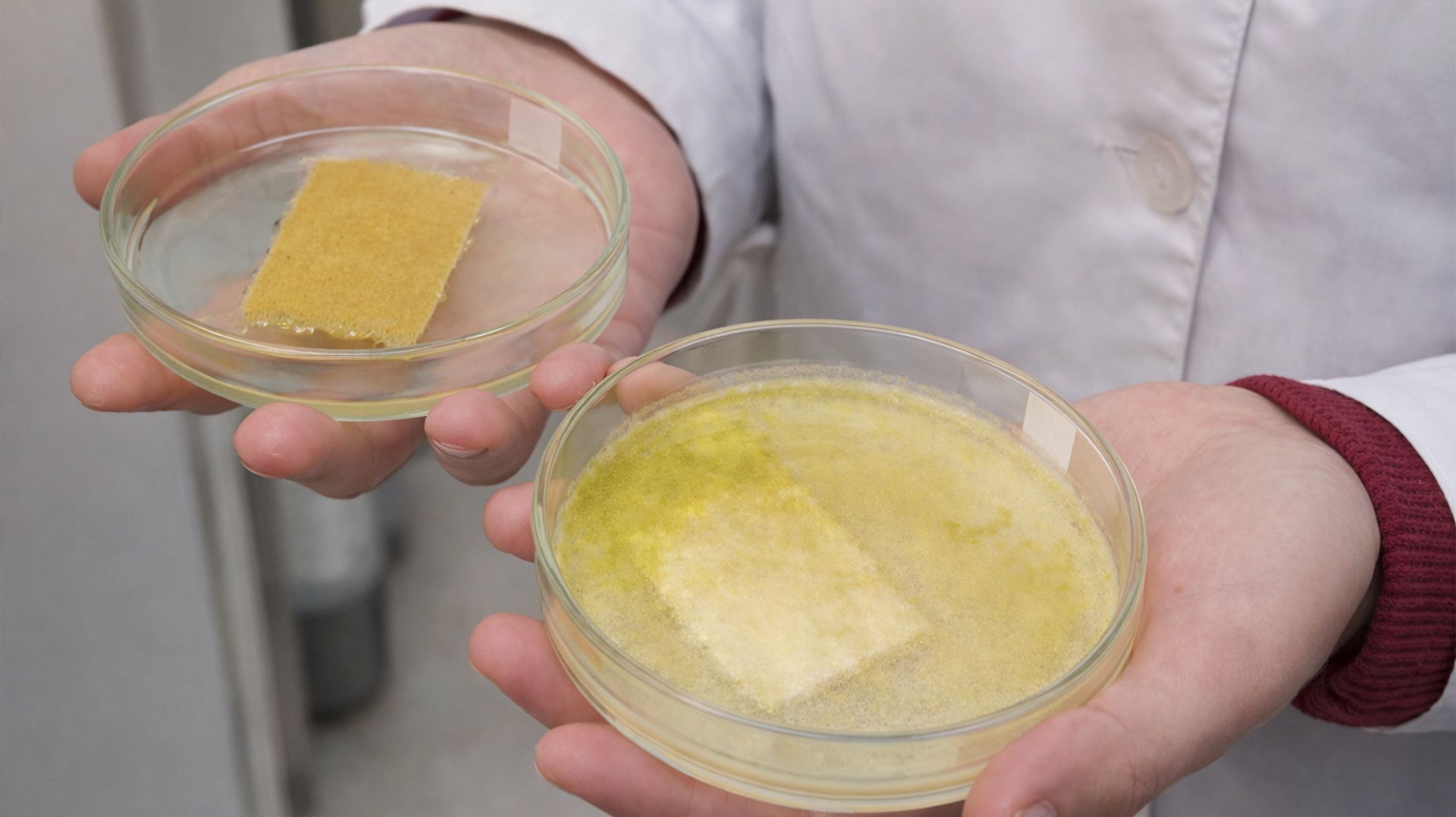 Устойчивую к внутрибольничным инфекциям создали исследователи в Санкт-Петербурге смотреть онлайн