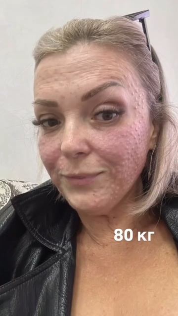 минус 63 кг🔥как меняется ШИКАРНО ЛИЦО 💪