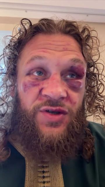 Рафаэль Физиев после поражения на UFC325 смотреть онлайн