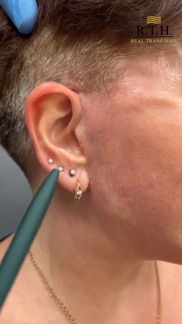 Месяц после комплексной операции