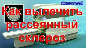 Как вылечить рассеянный склероз (2026)