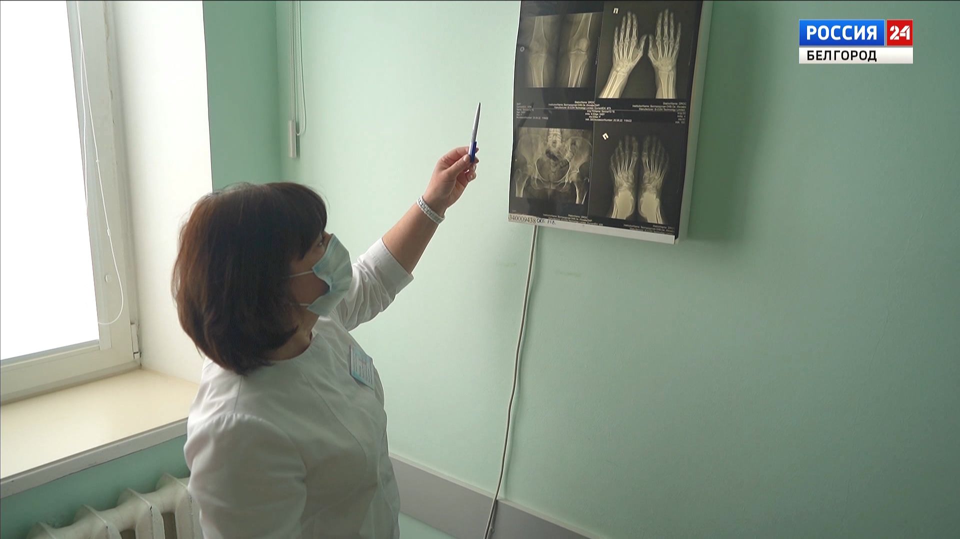 2 февраля - День осведомленности о ревматоидном артрите смотреть онлайн