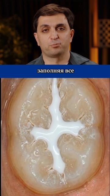 Идеальная ловушка для бактерий