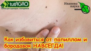 Как избавиться от бородавок и папиллом навсегда: эффективный способ.
