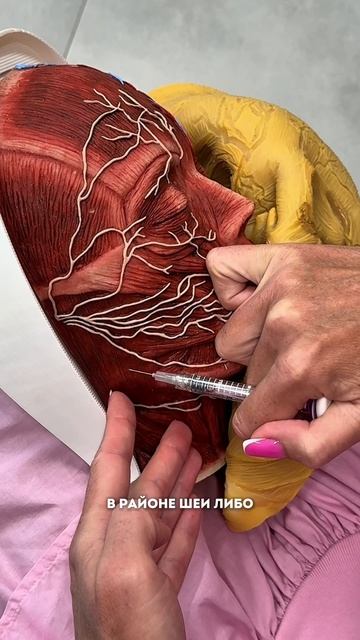 Контурная пластика углов Джоли