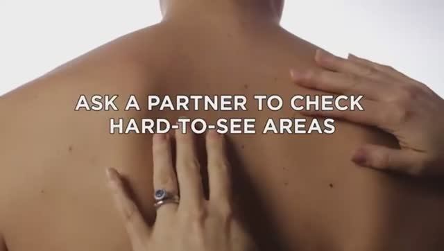 Не дайте раку кожи подкрасться к вам незаметно