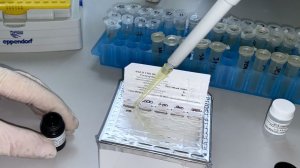 Заболевшие оспой обезьян в России в последнее время не выезжали за границу