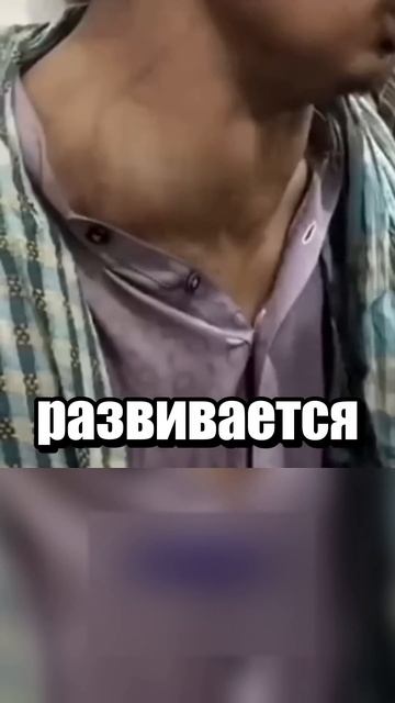 Немного о проф. болезнях