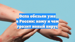 Оспа обезьян уже в России: кому и чем грозит новый вирус