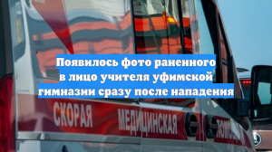 Появилось фото раненного в лицо учителя уфимской гимназии сразу после нападения