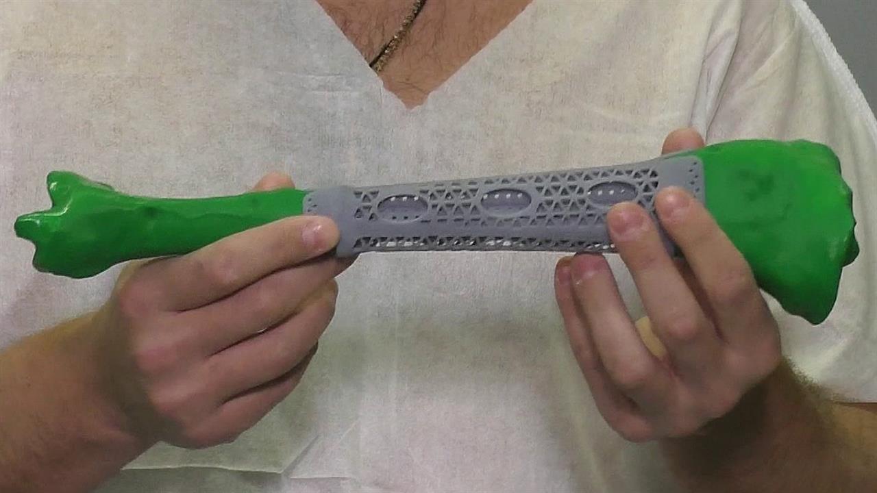 Высокотехнологичная медицина для наших бойцов выходит на новый уровень. смотреть онлайн