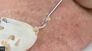 Чёрные Точки