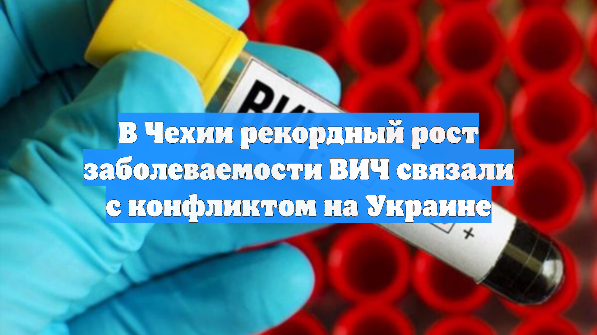 В Чехии рекордный рост заболеваемости ВИЧ связали с конфликтом на Украине смотреть онлайн