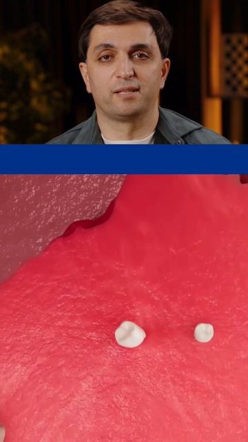 Удивительный случай из мира медицины!