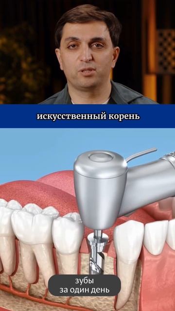 Просто о сложном: удаление зуба.