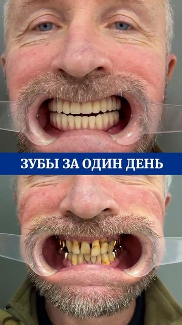 Результат пациента