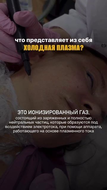 Холодная плазма в косметологии: технология, о которой должен знать каждый специалист!