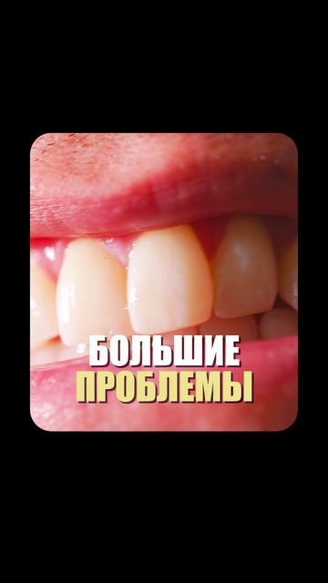 Ополаскиватели НЕЛЬЗЯ ИСПОЛЬЗОВАТЬ?🧐💧Кирилл Фомин🎙️Константин Крылов🦷