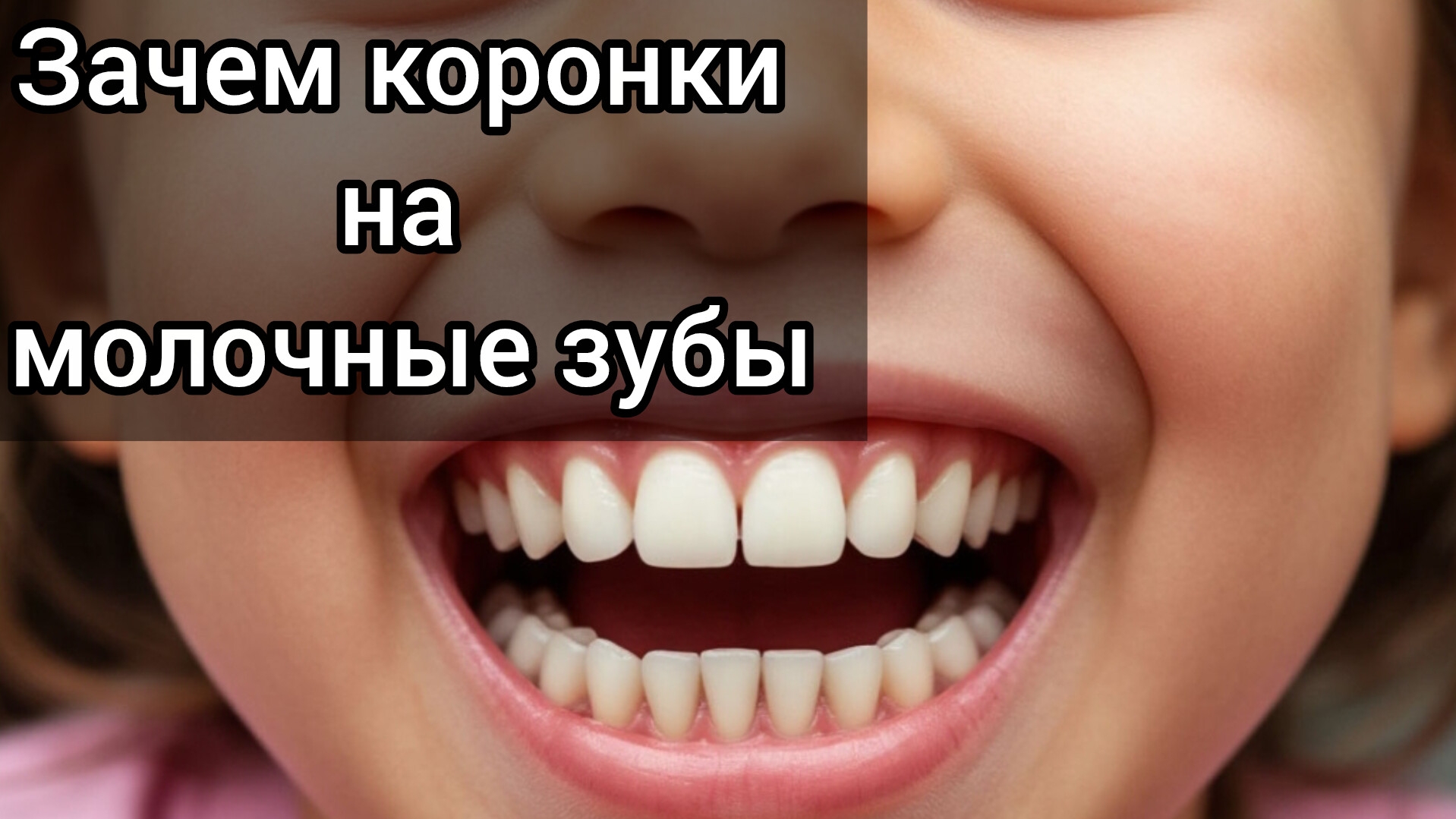 Коронки на молочные зубы. Когда происходит смена молочных зубов.
