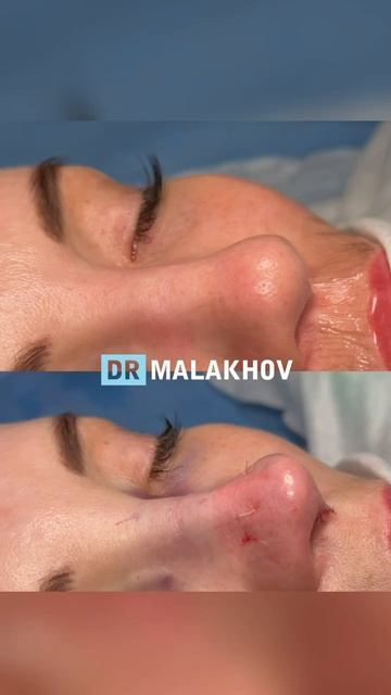 ДО/ПОСЛЕ на операционном столе 🤩