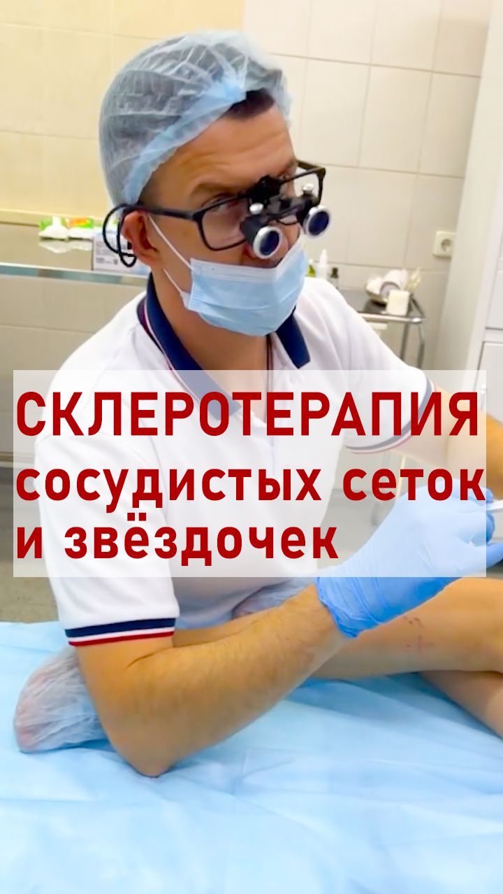 Склеротерапия: от процедуры до идеальных ног. Полный разбор.