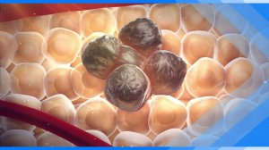 04.02.2026 Рак молодеет. Медики рассказали, как свести риск заболеть к минимуму