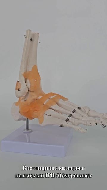 Ограничения в выборе обуви #остеопороз #крепкиекости #кальций